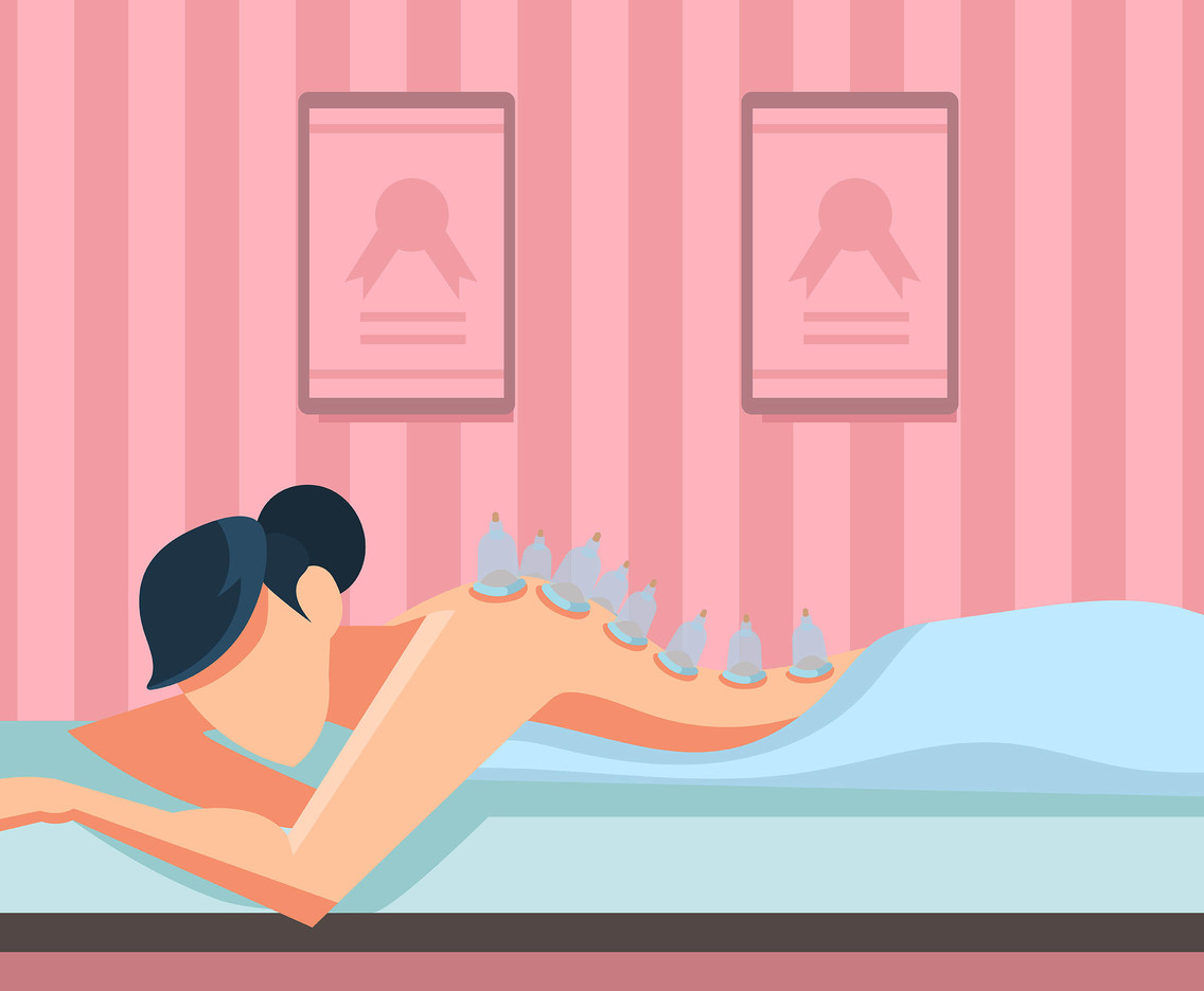 Cupping Therapy Vector Vector Art And Graphics